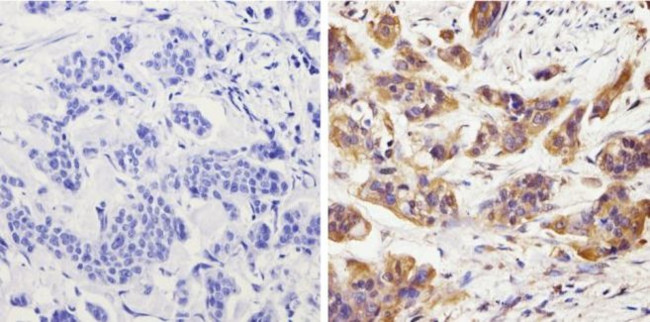 Survivin Antibody in Immunohistochemistry (Paraffin) (IHC (P))