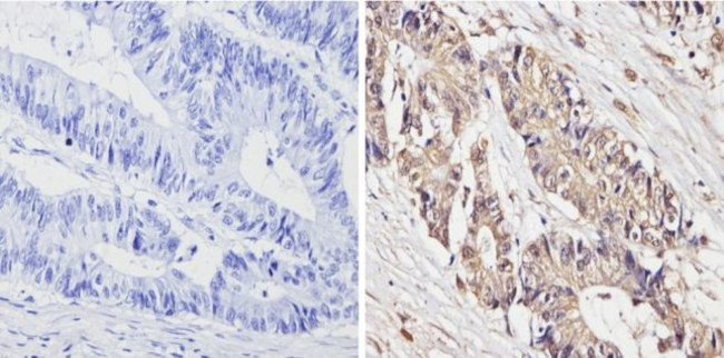 Survivin Antibody in Immunohistochemistry (Paraffin) (IHC (P))