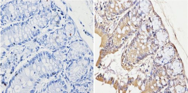 Survivin Antibody in Immunohistochemistry (Paraffin) (IHC (P))