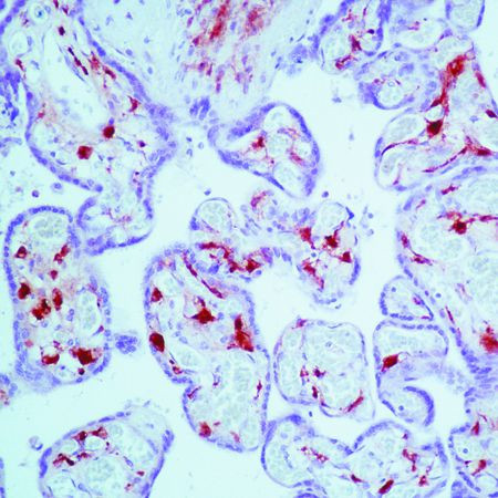 Factor XIII A Antibody in Immunohistochemistry (Paraffin) (IHC (P))