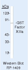 Factor XIII A Antibody in Western Blot (WB)