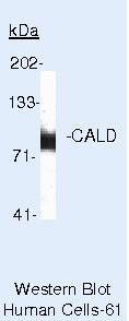 Caldesmon Antibody in Western Blot (WB)