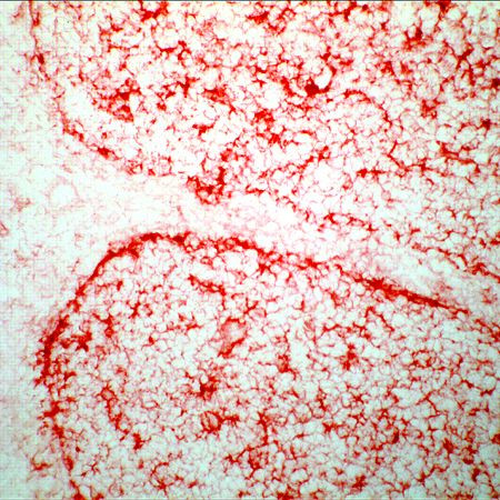 GGT1 Antibody in Immunohistochemistry (Frozen) (IHC (F))