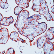 Clathrin Light Chain Antibody in Immunohistochemistry (Paraffin) (IHC (P))