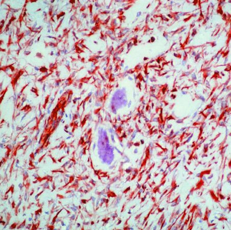 Vimentin Antibody in Immunohistochemistry (Paraffin) (IHC (P))