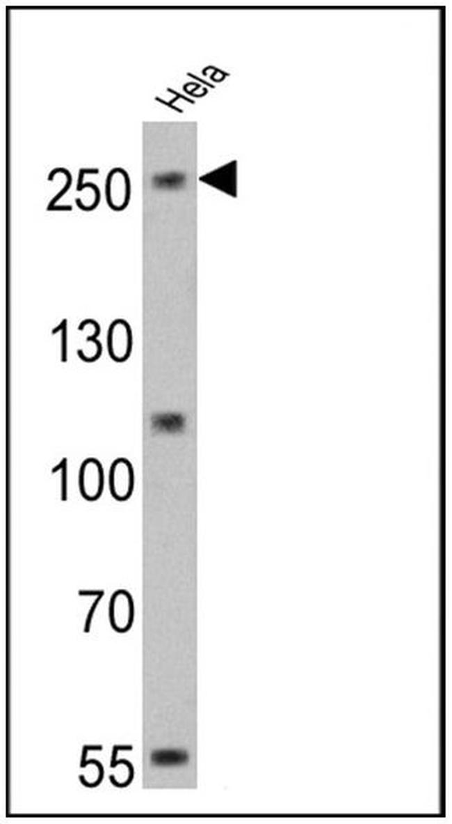 NOTCH1 Antibody in Western Blot (WB)