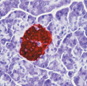 Insulin/Proinsulin Antibody in Immunohistochemistry (Paraffin) (IHC (P))