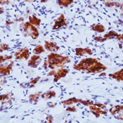 Thyroid Stimulating Hormone Antibody in Immunohistochemistry (Paraffin) (IHC (P))