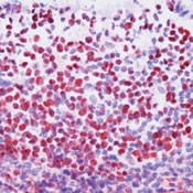 MCM2 Antibody in Immunohistochemistry (Paraffin) (IHC (P))