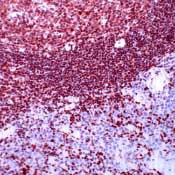 ETS1 Antibody in Immunohistochemistry (Paraffin) (IHC (P))