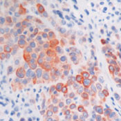 Cytokeratin 5/6 Antibody in Immunohistochemistry (Paraffin) (IHC (P))