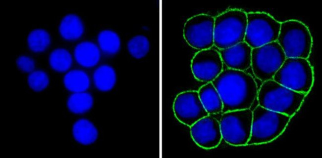 EpCAM Antibody in Immunocytochemistry (ICC/IF)