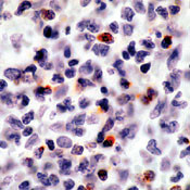 Perforin Antibody in Immunohistochemistry (Paraffin) (IHC (P))