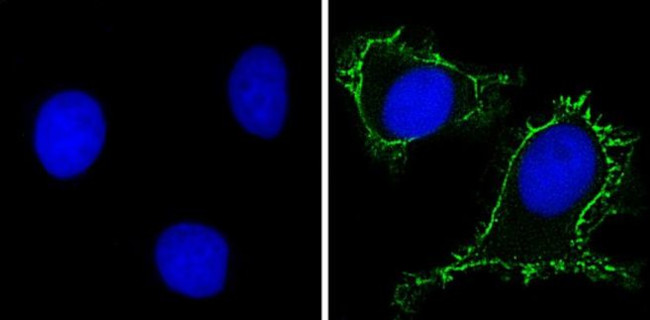 RPSA Antibody in Immunocytochemistry (ICC/IF)