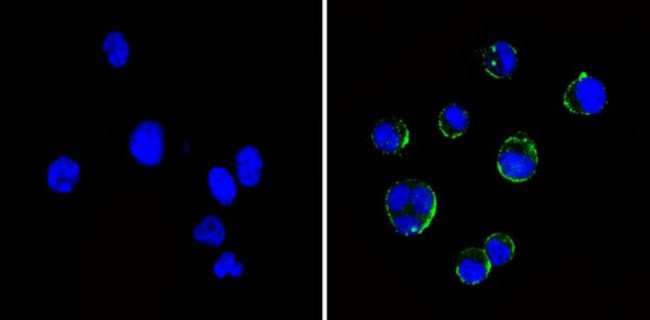 ICAM-1 Antibody in Immunocytochemistry (ICC/IF)