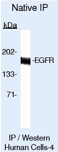 EGFR Antibody in Immunoprecipitation (IP)