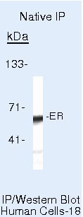 Estrogen Receptor alpha Antibody in Immunoprecipitation (IP)