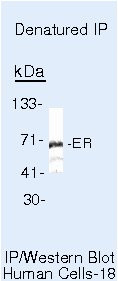 Estrogen Receptor alpha Antibody in Immunoprecipitation (IP)