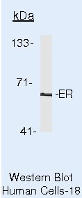 Estrogen Receptor alpha Antibody in Western Blot (WB)