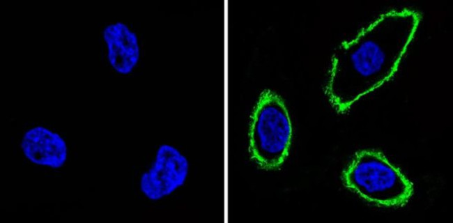 EGFR Antibody in Immunocytochemistry (ICC/IF)