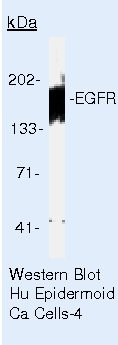 EGFR Antibody in Western Blot (WB)