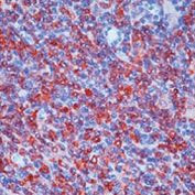 Syk Antibody in Immunohistochemistry (IHC)