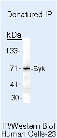 Syk Antibody in Immunoprecipitation (IP)