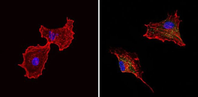 Chromogranin A Antibody in Immunocytochemistry (ICC/IF)