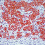 Chromogranin A Antibody in Immunohistochemistry (Paraffin) (IHC (P))