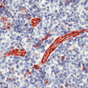 CD31 Antibody in Immunohistochemistry (Paraffin) (IHC (P))