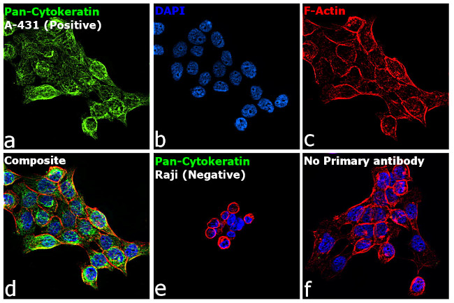 Cytokeratin Pan Antibody in Immunocytochemistry (ICC/IF)