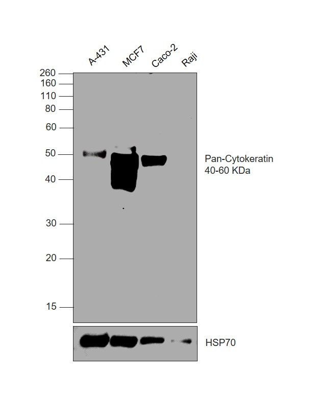 Cytokeratin Pan Antibody