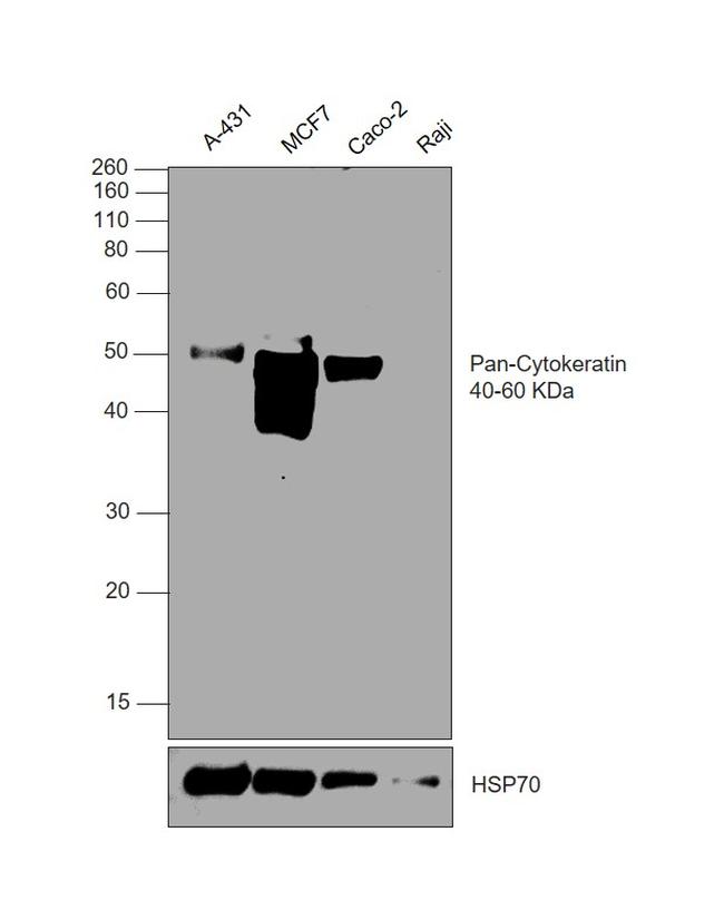 Cytokeratin Pan Antibody in Western Blot (WB)