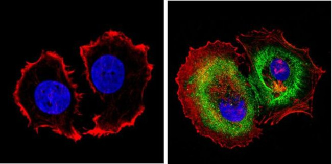 Cytokeratin Pan Antibody in Immunocytochemistry (ICC/IF)