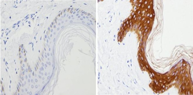 Cytokeratin Pan Antibody in Immunohistochemistry (Paraffin) (IHC (P))