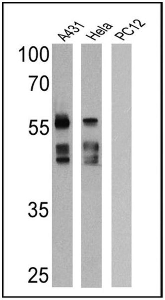 Cytokeratin Pan Antibody in Western Blot (WB)