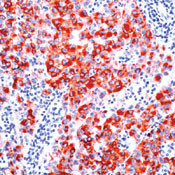 PMEL Antibody in Immunohistochemistry (Paraffin) (IHC (P))