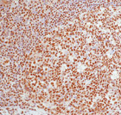 DNA-PK Antibody in Immunohistochemistry (Paraffin) (IHC (P))