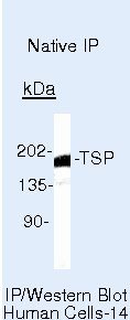 Thrombospondin 1 Antibody in Immunoprecipitation (IP)