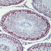 XRCC1 Antibody in Immunohistochemistry (Paraffin) (IHC (P))