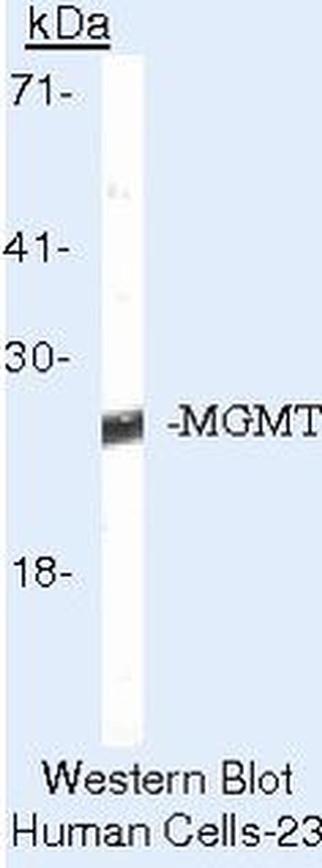 MGMT Antibody in Western Blot (WB)