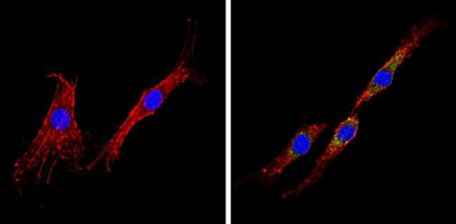 INSR Antibody in Immunocytochemistry (ICC/IF)