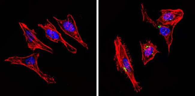 INSR Antibody in Immunocytochemistry (ICC/IF)