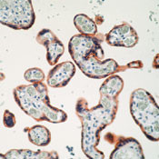 INSR Antibody in Immunohistochemistry (Paraffin) (IHC (P))