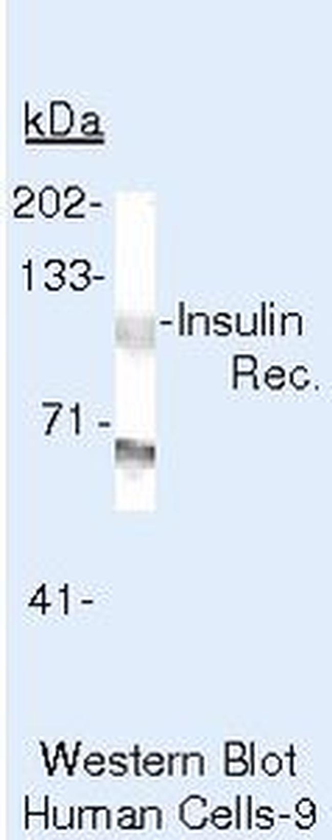 INSR Antibody in Western Blot (WB)