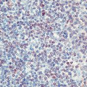 Cdc25A Antibody in Immunohistochemistry (Paraffin) (IHC (P))