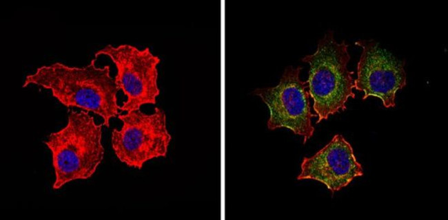 IGF1R alpha Antibody in Immunocytochemistry (ICC/IF)