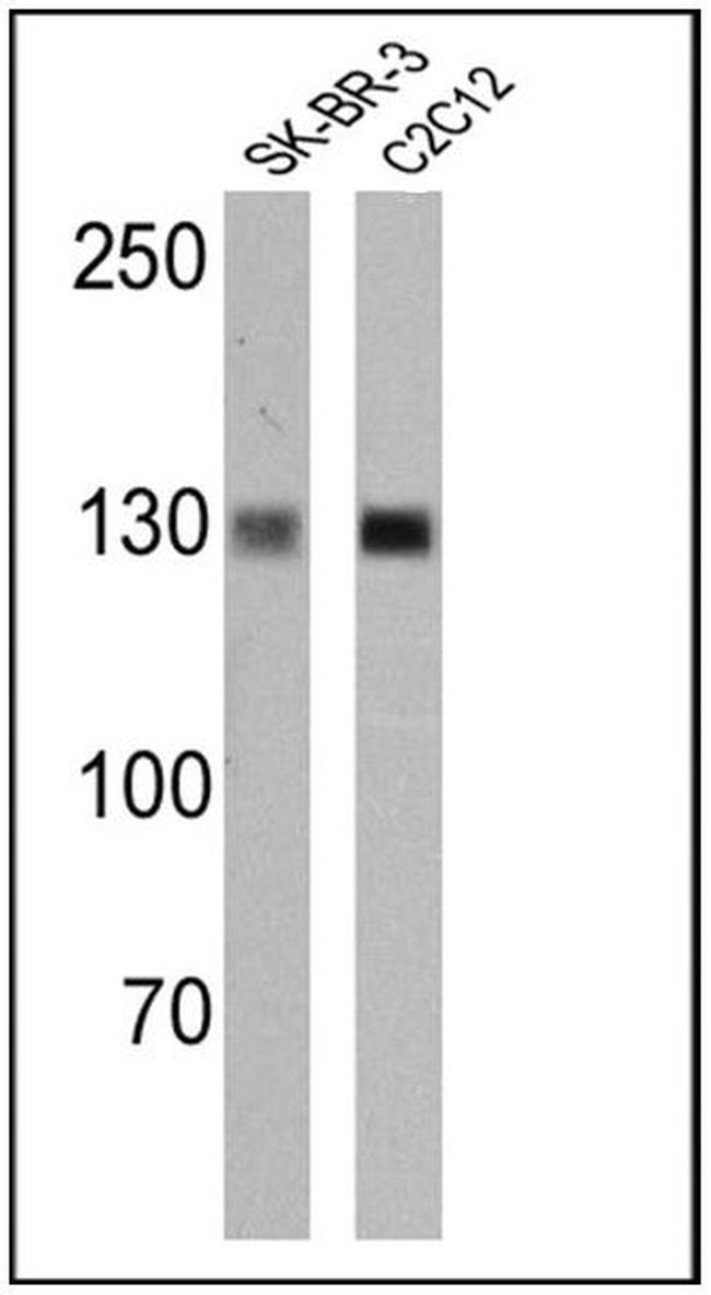 IGF1R alpha Antibody in Western Blot (WB)