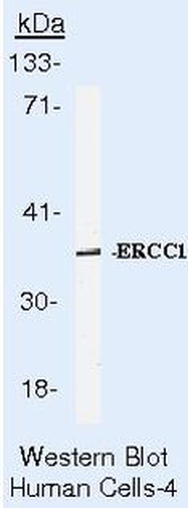 ERCC1 Antibody in Western Blot (WB)