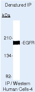 EGFR Antibody in Immunoprecipitation (IP)